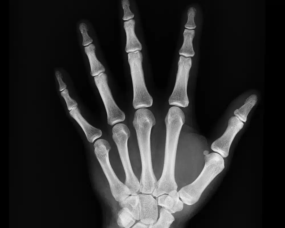 The best mobile X-ray apps